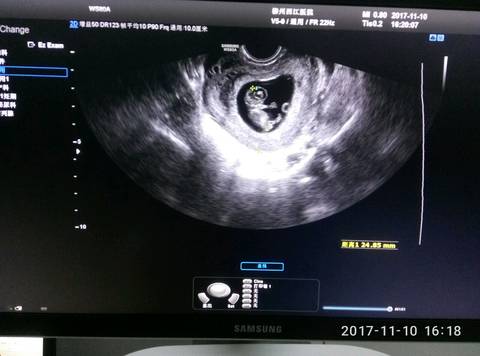 journal_insert_pic_881274473