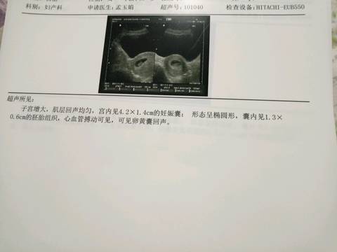 journal_insert_pic_881022218