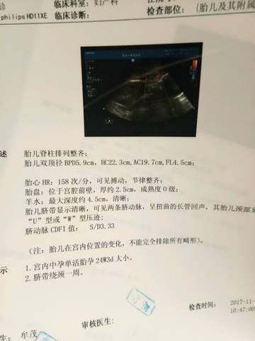 journal_insert_pic_881013624