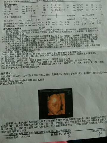 journal_insert_pic_884681315