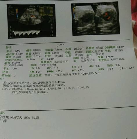 journal_insert_pic_884629784