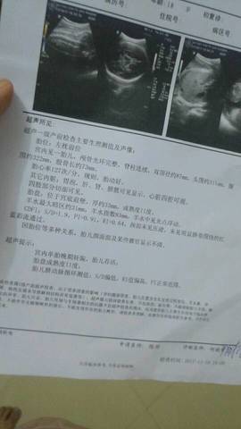 journal_insert_pic_885678553