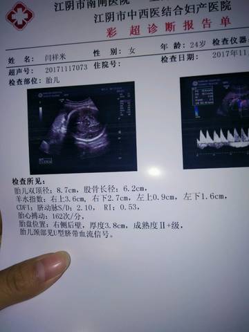 journal_insert_pic_885998145