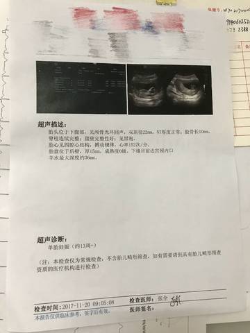 journal_insert_pic_888157082