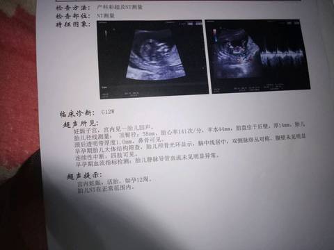 journal_insert_pic_888340001