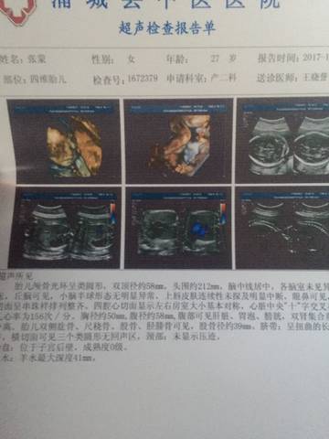 journal_insert_pic_888451585