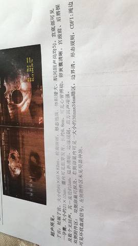 journal_insert_pic_888816301