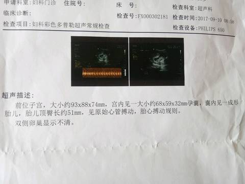 journal_insert_pic_888888310