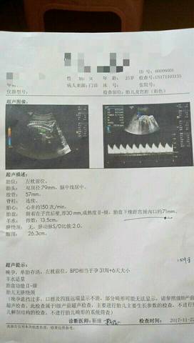 journal_insert_pic_889562661