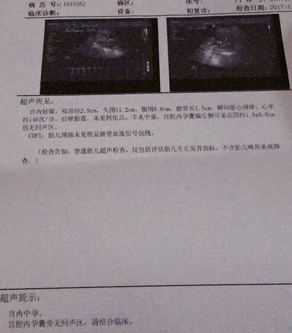 journal_insert_pic_892006202