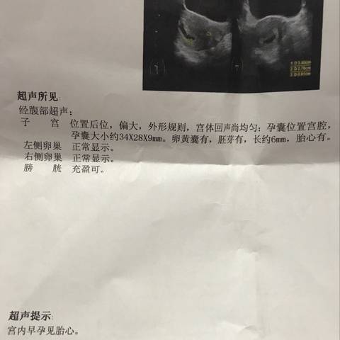 journal_insert_pic_896087557