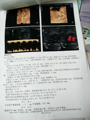 journal_insert_pic_897184790