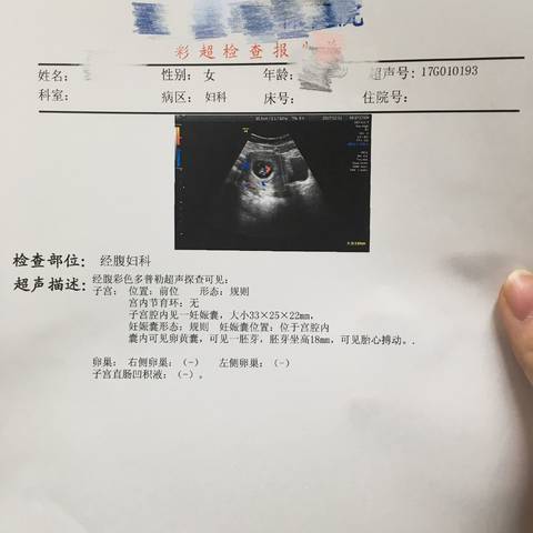 journal_insert_pic_902394832