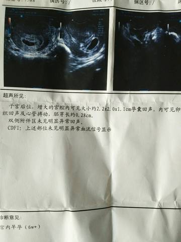 journal_insert_pic_903124100