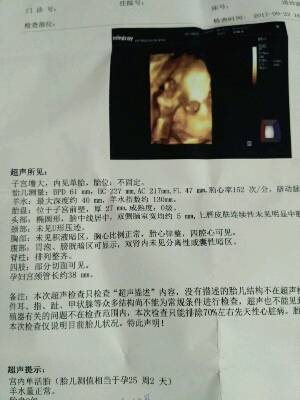 journal_insert_pic_903412537