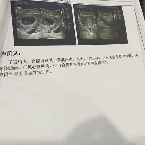 journal_insert_pic_904355666