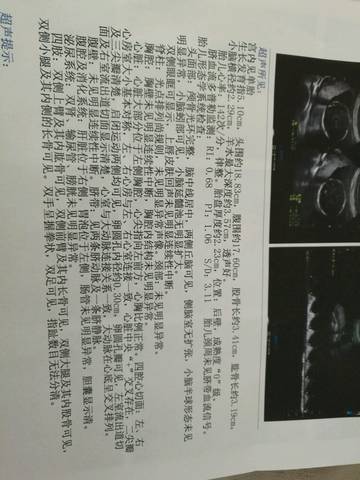 journal_insert_pic_905653490