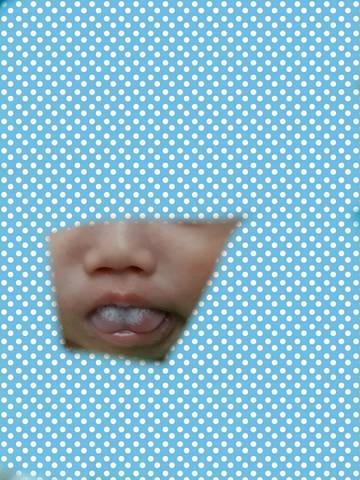 婴儿舌头上的奶垢很厚图片