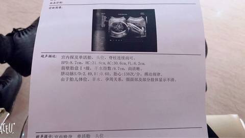 journal_insert_pic_911753085