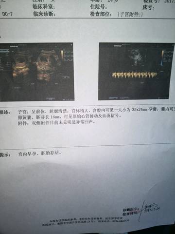 journal_insert_pic_911851435