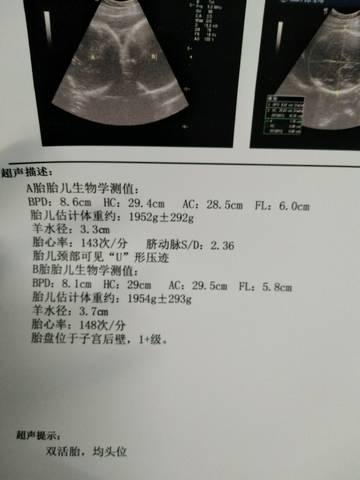 journal_insert_pic_914501159