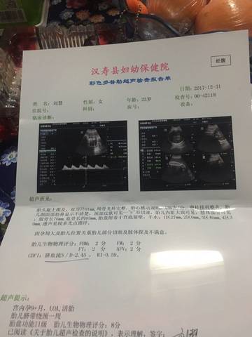 journal_insert_pic_916228470