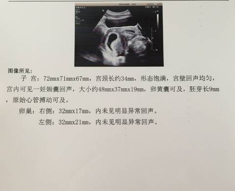 journal_insert_pic_917325473
