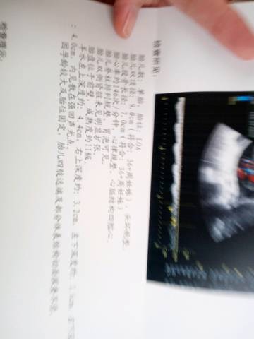 journal_insert_pic_917350148