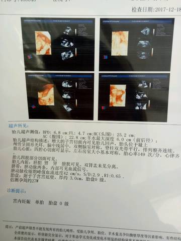 journal_insert_pic_917751454