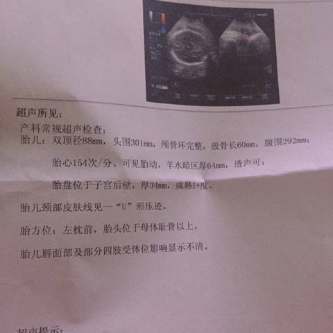 journal_insert_pic_917474805