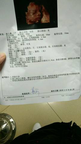 journal_insert_pic_918228197