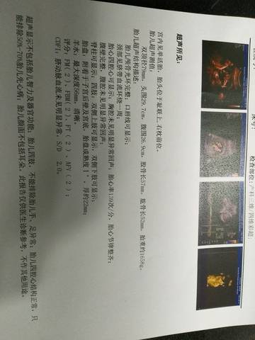 journal_insert_pic_918620022