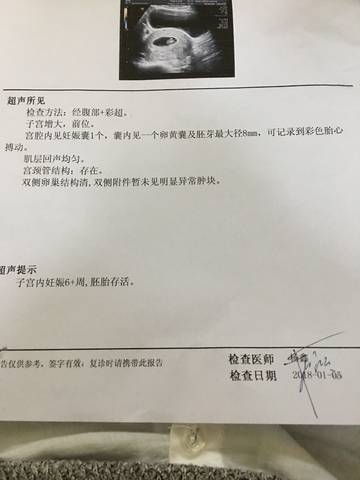 journal_insert_pic_919502264