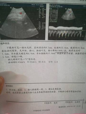 journal_insert_pic_920887319
