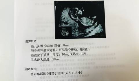 journal_insert_pic_921472017