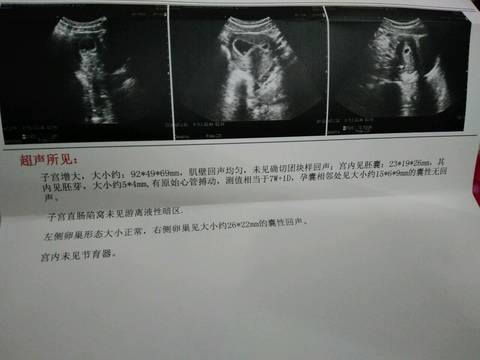 journal_insert_pic_921423306