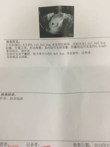 journal_insert_pic_921617615
