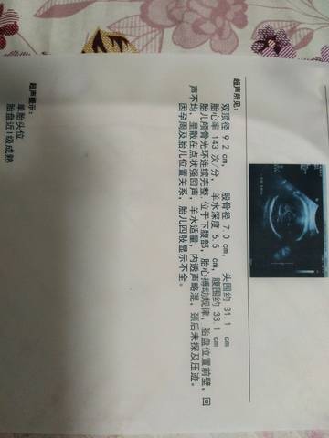 journal_insert_pic_922434722