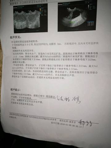 journal_insert_pic_922108964