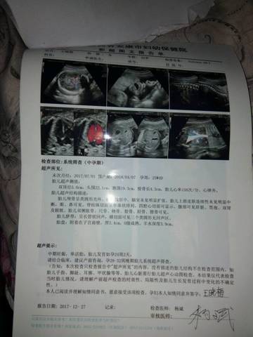 journal_insert_pic_922262656