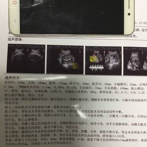 journal_insert_pic_922521853