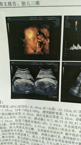 journal_insert_pic_922951706