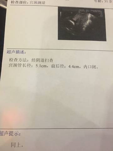 journal_insert_pic_924177240