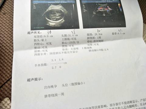 journal_insert_pic_927738741
