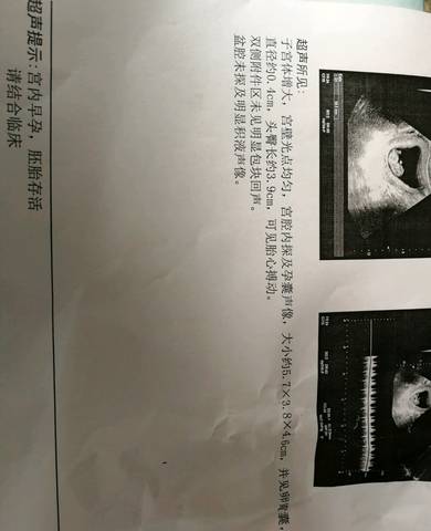 journal_insert_pic_928017644