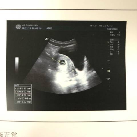 journal_insert_pic_928254410
