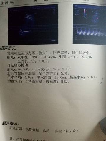 journal_insert_pic_928290879