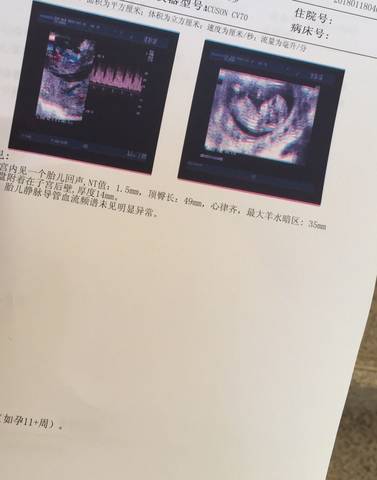 journal_insert_pic_929495795