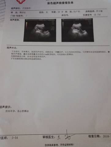 journal_insert_pic_929000365