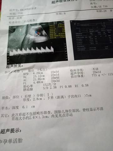 journal_insert_pic_929812981
